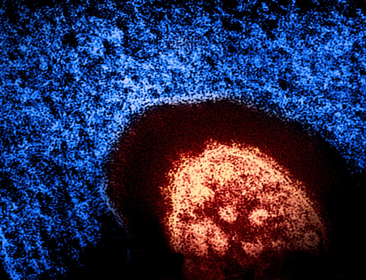 Colorized electron micrograph of a red measles virus particle against blue cellular material.