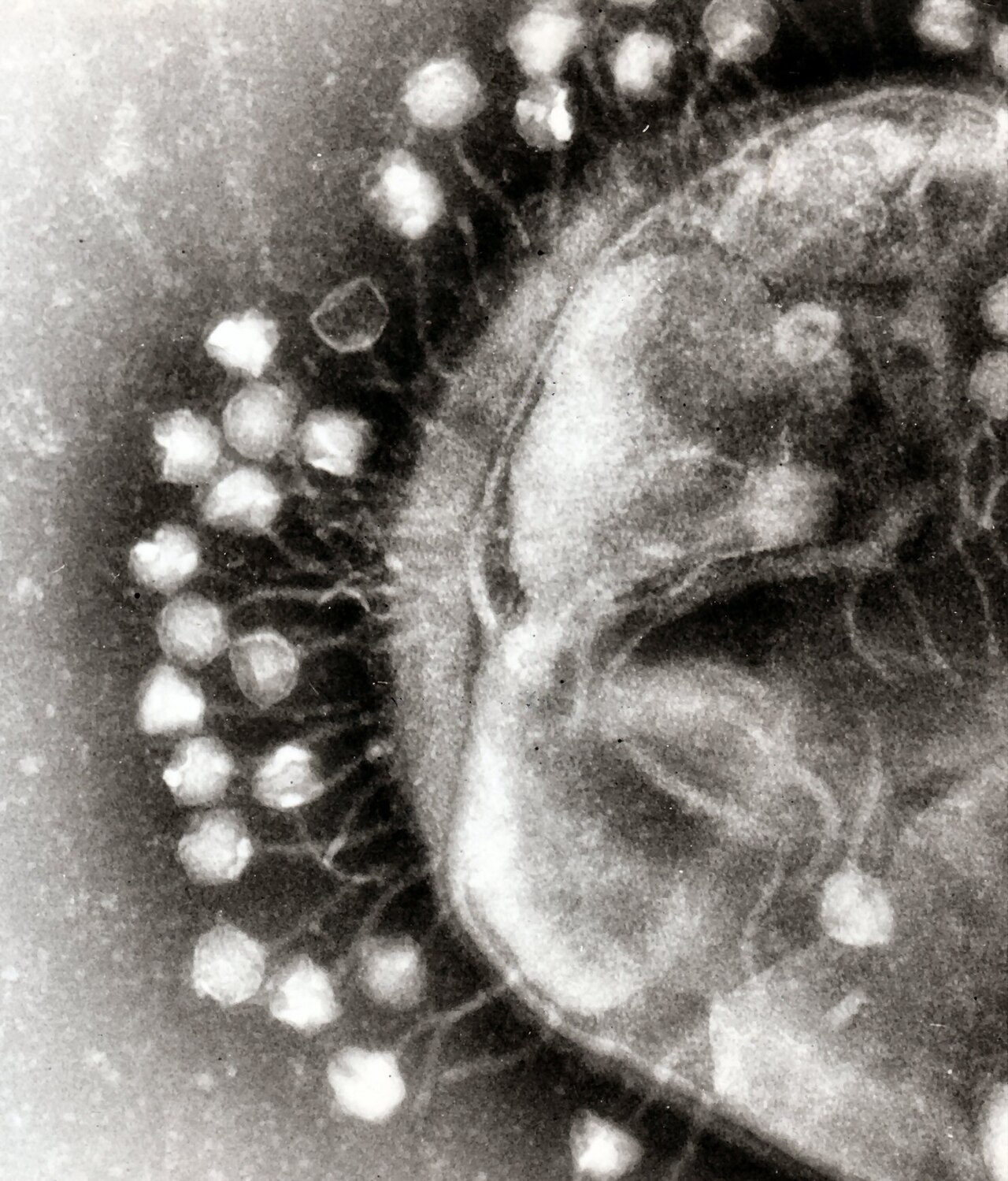 Transmission electron micrograph showing numerous bacteriophages attached to the surface of a bacterial cell.