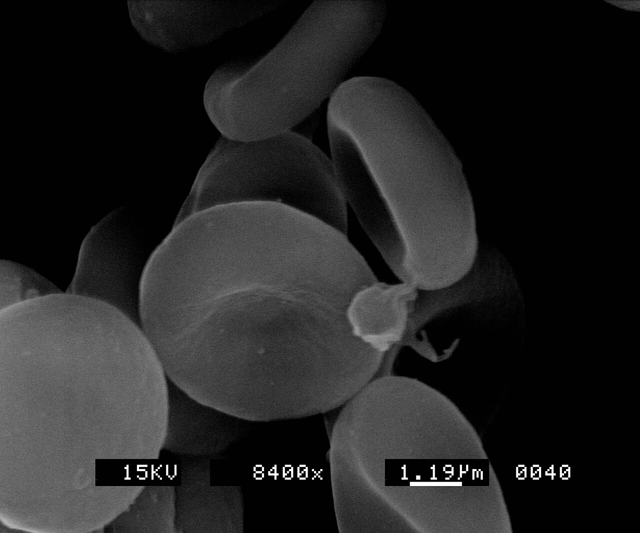 Grayscale scanning electron micrograph of several disc-shaped red blood cells at 8,400× magnification.